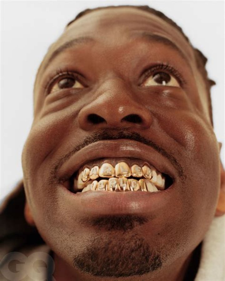 How did people get gold teeth?